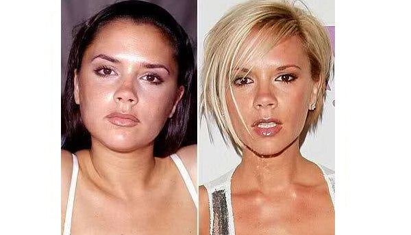 five-celebrities-who-have-had-a-nose-job