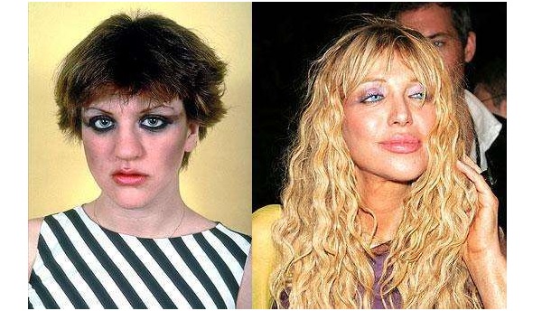 five-celebrities-who-have-had-a-nose-job