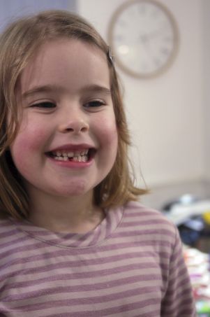 the-extras-you-should-avoid-when-getting-a-dental-insurance-plans