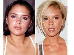 five-celebrities-who-have-had-a-nose-job